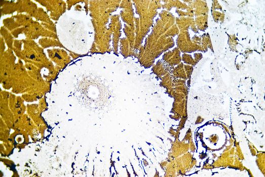 Microscopic soot particles