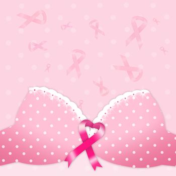 Breast cancer prevention