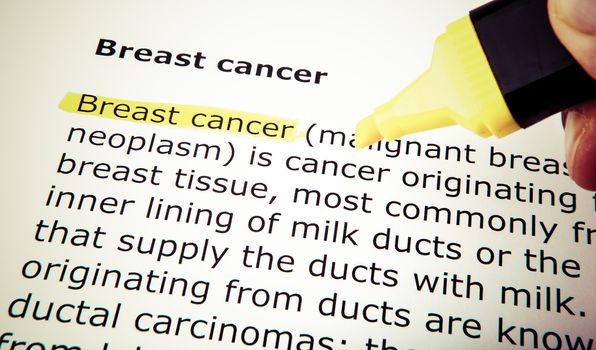 Breast cancer
