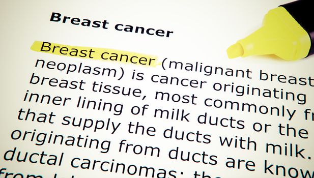 Breast cancer