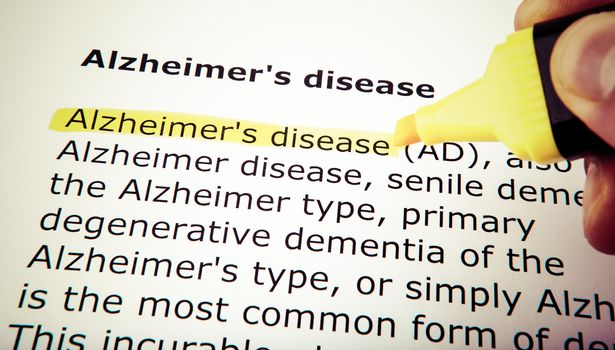 Alzheimer's disease