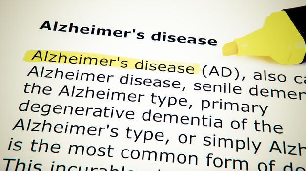 Alzheimer's disease