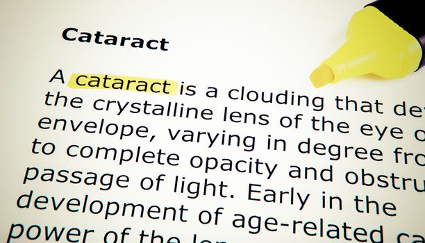 Cataract