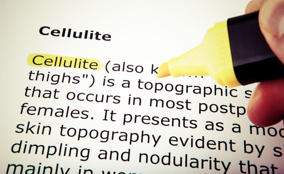 Cellulite