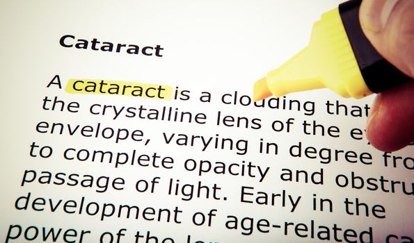 Cataract