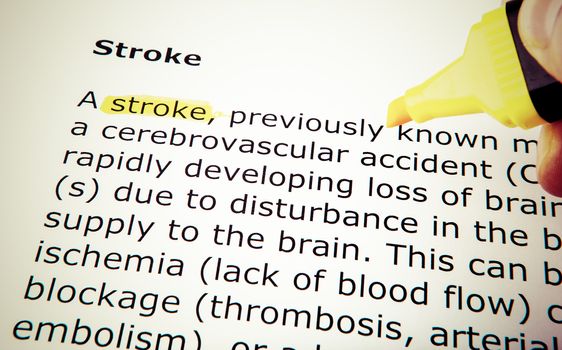 Stroke