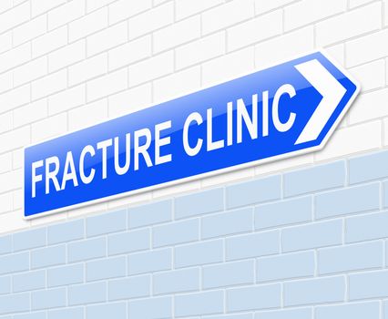Illustration depicting a sign directing to the Fracture Clinic.