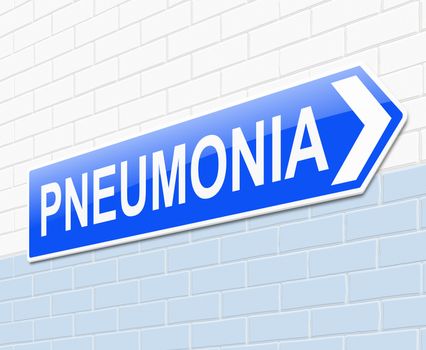 Illustration depicting a sign with a pneumonia concept.