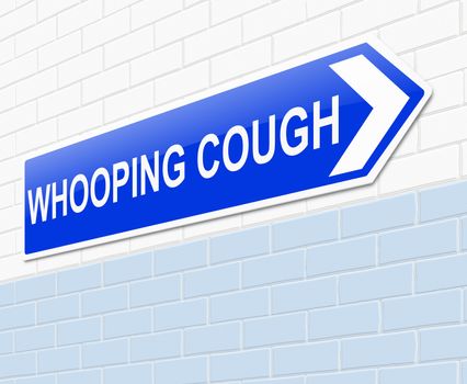 Illustration depicting a sign with a whooping cough concept.