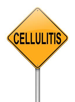 Illustration depicting a sign with a Cellulitis concept.
