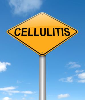 Illustration depicting a sign with a Cellulitis concept.