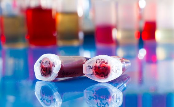 Sample of stem cells in the reaction tube
