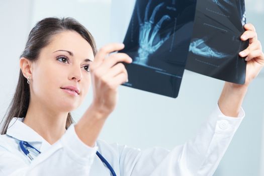 Young woman doctor looking at x-ray photo 