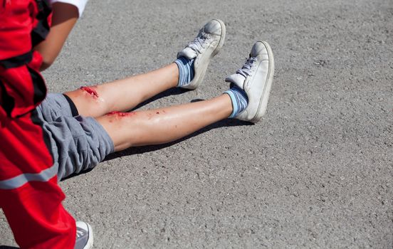 Serious injuries on girl's legs