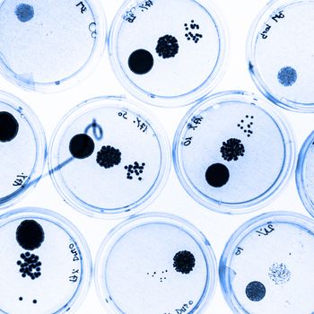 Growing Bacteria in Petri Dishes on agar gel as a part of scientific experiment.