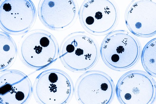 Growing Bacteria in Petri Dishes on agar gel as a part of scientific experiment.