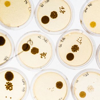 Growing Bacteria in Petri Dishes on agar gel as a part of scientific experiment.