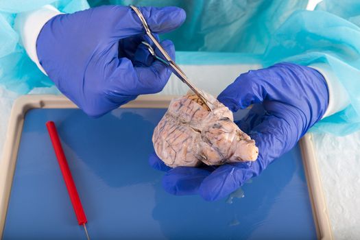 Pathologist in a laboratory opening up a tissue sample for testing and analysis, close up of the gloved hands and tissue