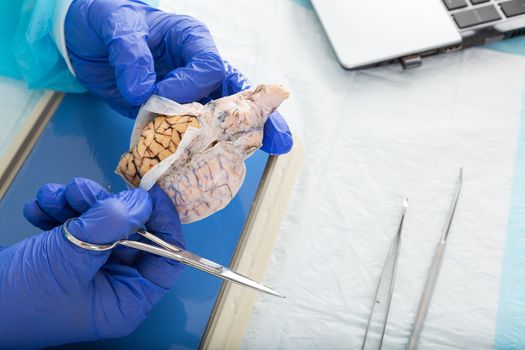 Pathologist opening a tissue sample in the laboratory in order to conduct in vitro or post mortem analysis to diagnose a disease or confirm the cause of death