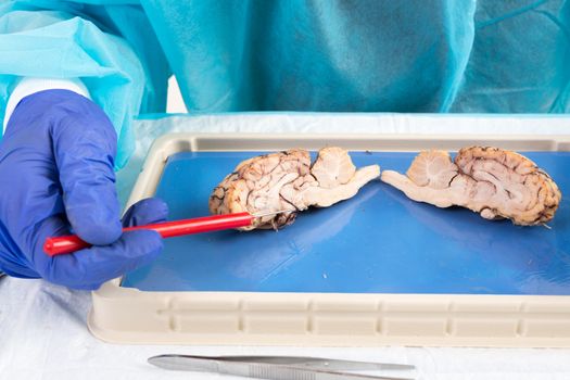 Cross-section of a cow brain in a laboratory with an anatomy student pointing with a probe to the area of the pituitary gland and hypothalamus as it lies on a dissecting tray during class