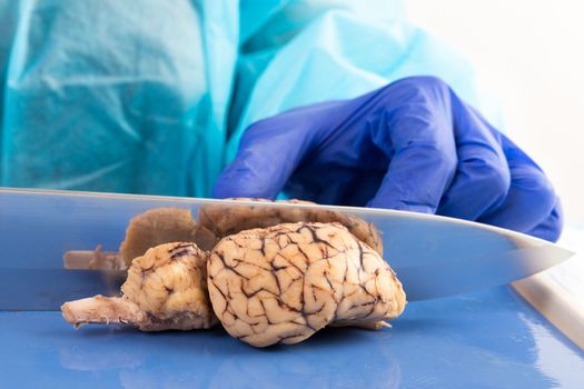 Slicing a cow brain with a blade in anatomy class down the mid section to obtain a longitudinal cross-section to study the structure of the tissue