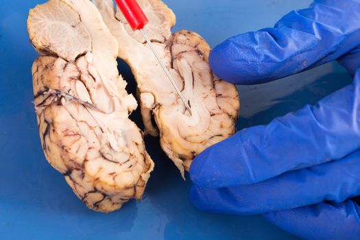 Cross-section of a cow brain showing the convoluted tissue with a probe pointing to the frontal lobe