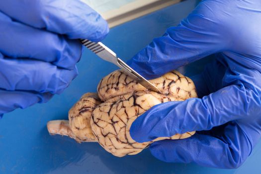 Close up of the gloved hands of an anatomy student, veterinarian, medical technologist or pathologist dissecting a cow brain with a surgical scalpel