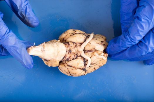 Physiology student dissecting a cow brain diplaying the underside of the organ with the brainstem, optical nerves and olfactory tract