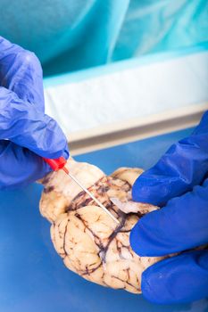 Physiology student examining a brain of a cow taking a closer look at an optic nerve before commencing the dissection