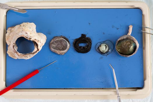Dissecting a sheep eye with the various tissues displayed on a tray including the eyeball, lens and surrounding muscle from the eye socket