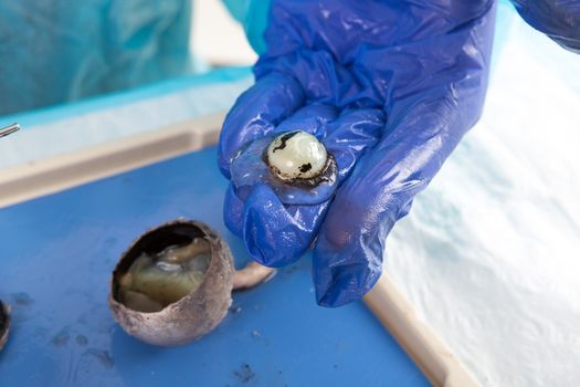 Physiology student displaying the lens from the dissected eye of a sheep on her gloved fingers as she studies the structure and function of the body