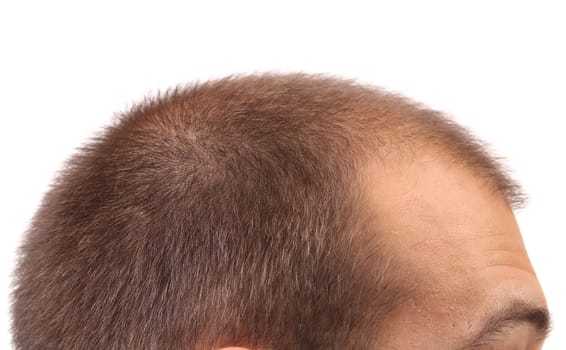 Close up of mans head. Whole background.