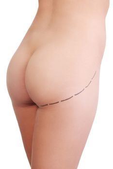 Woman's buttock prepared to plastic surgery , isolated on white