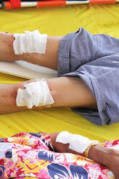 First aid by use gauze arrange cover on wound of leg