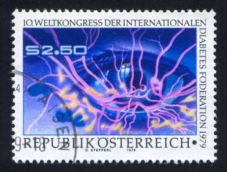 AUSTRIA - CIRCA 1979: stamp printed by Austria, shows Diseased eye and blood vessels, circa 1979