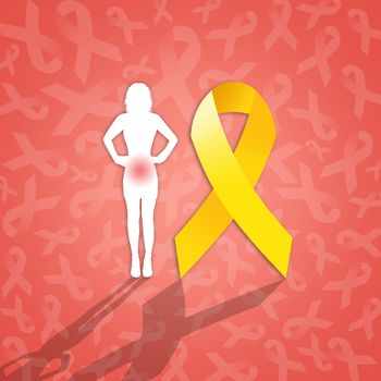 illustration of woman and yellow ribbon for Endometriosis