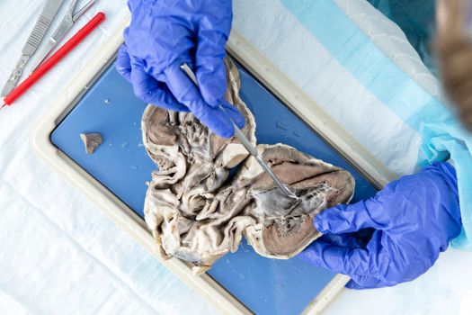 View from above of an anatomy student analysing a bisected sheep heart using a probe to look at the internal structure of the ventricles and valves