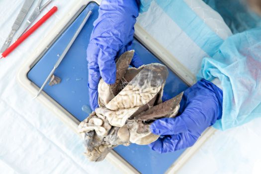 Overhead view of the hands of a medical student dissecting the heart of a sheep during anatomy classes slicing open the walls of the ventricles to study the internal structure