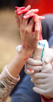 Treatment of hand injury