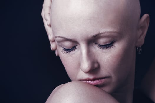 Portrait of a young bald-headed girl in studio