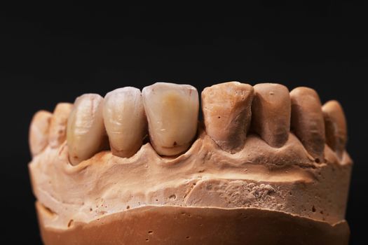 Dental impression. Isolated on a black background.