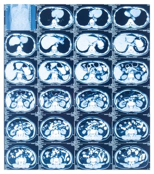 Medical diagnosis background. CT scan