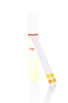 Urine sample with blood in test tube and pH litmus paper test strips isolated on white background. Acidic or alkaline, health or disease. Health and medical concept.