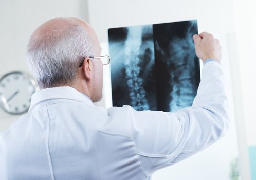 Male senior doctor looking at x-ray images of human spine.