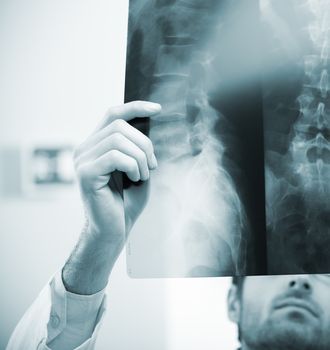 Professional radiologist examining an X-ray image of human spine.