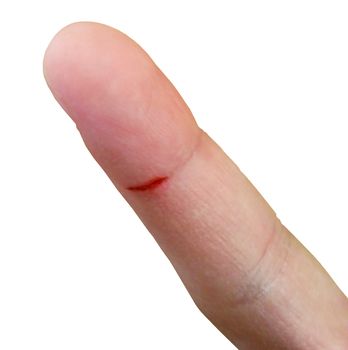 Human finger with a small cut wound, isolated on a white background
