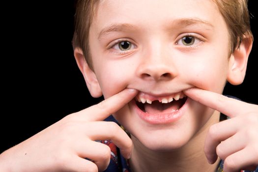 Young boy with beautiful green eyes who has one tooth missing