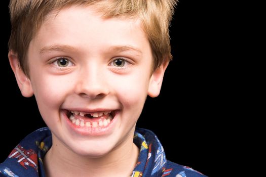 Young boy with beautiful green eyes who has one tooth missing