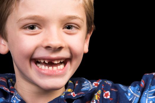 Young boy with beautiful green eyes who has one tooth missing