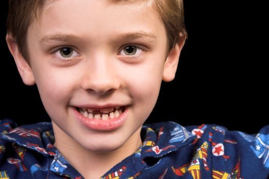 Young boy with beautiful green eyes who has one tooth missing